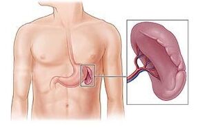 põrna patoloogia kui valu põhjus vasaku abaluu all